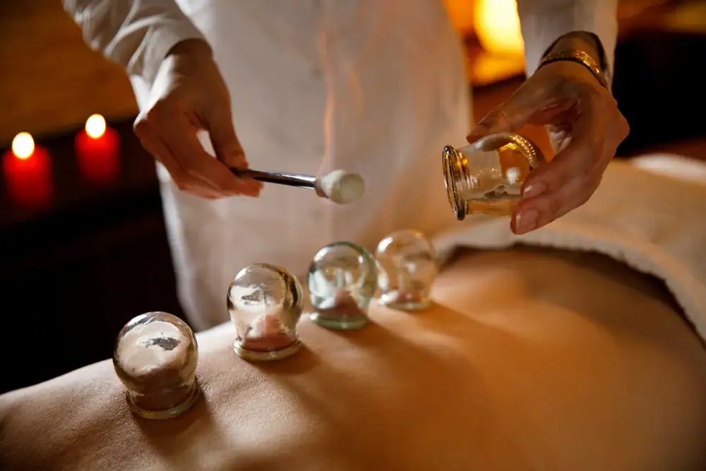 A practitioner performs cupping therapy on a person's back in this calm setting, ideal for those seeking alternative wellness alongside physical therapy in Suffolk & Nassau County, NY. Candles glow softly in the background, enhancing relaxation.