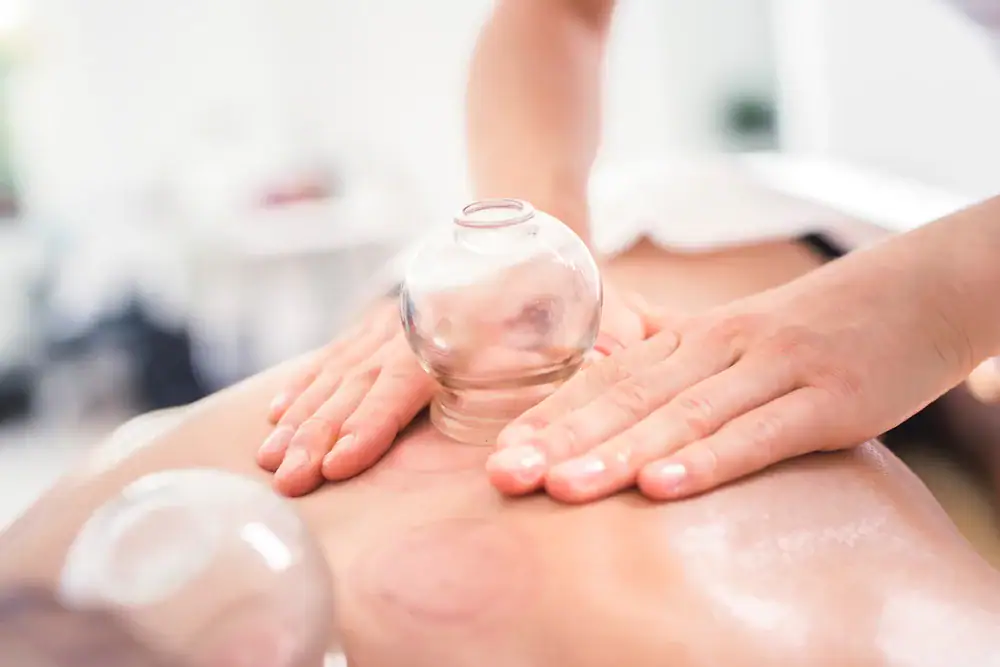A person receives cupping therapy on their back with glass cups, while a practitioner—trained in physical therapy Suffolk & Nassau County—gently presses near the cups with both hands. The skin appears slightly red under the cups.
