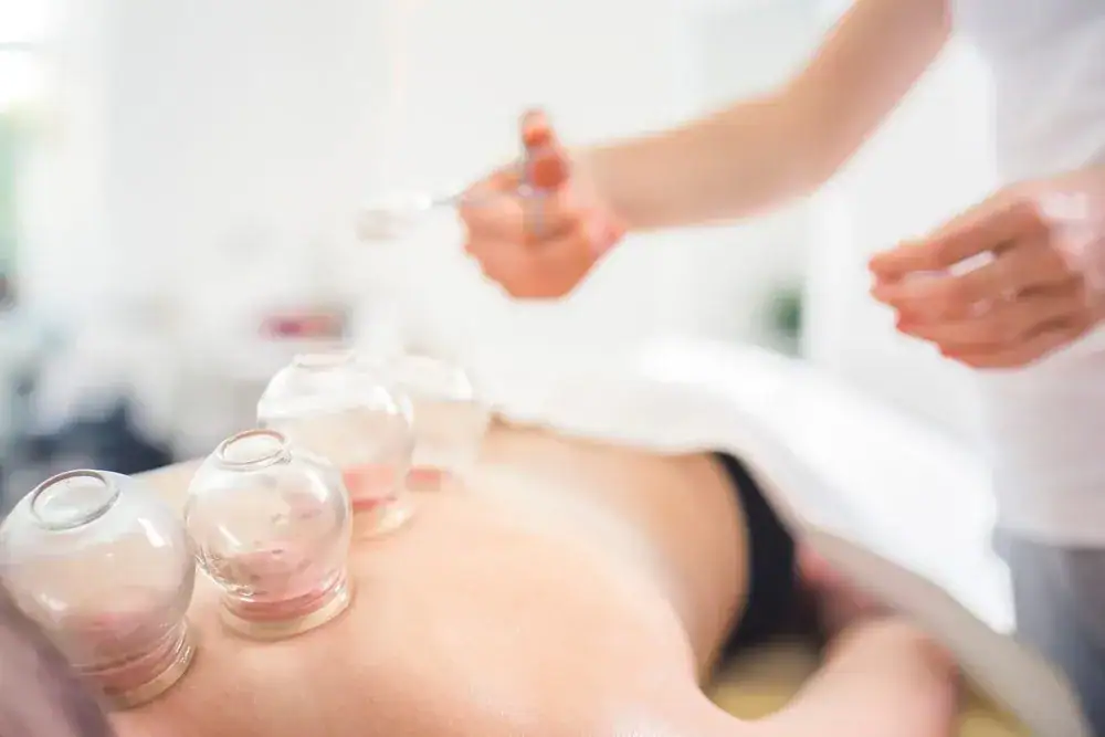 A person is lying face down with several glass cupping therapy jars on their bare back, while a practitioner prepares another jar in a bright, clean room at a physical therapy Suffolk & Nassau County clinic in NY.